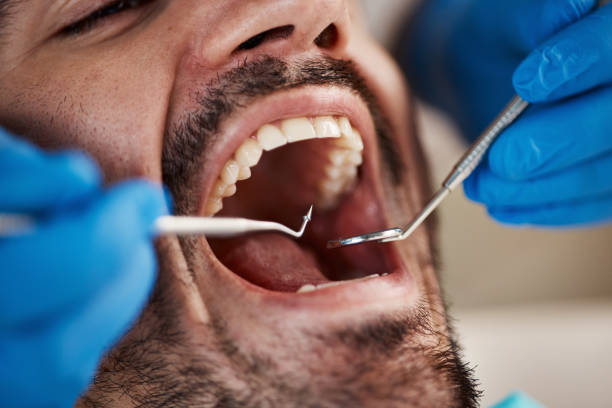 Best Emergency Dental Care for Sports Injuries in Choctaw, OK